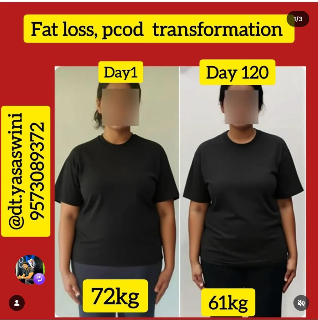 PCOD & Fat Loss